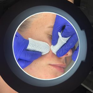 Limpieza facial personalizada